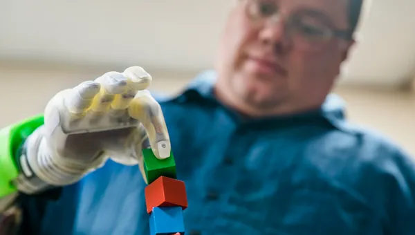 A man using a prosthetic arm.